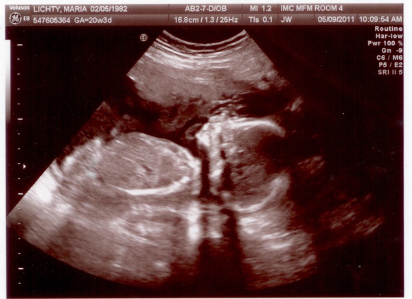 It’s A…
